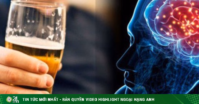 Uống Rượu Bia: Bao Nhiêu Là "Quá" và Tác Động Nghiêm Trọng Đến Đột Quỵ?